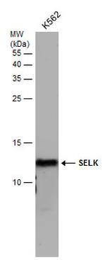 SELK Antibody in Western Blot (WB)