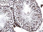 GFM2 Antibody in Immunohistochemistry (Paraffin) (IHC (P))