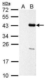 PSRC1 Antibody in Western Blot (WB)