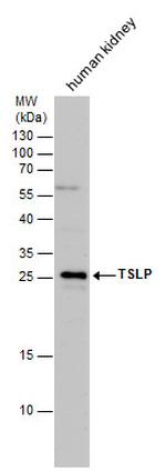 TSLP Antibody in Western Blot (WB)