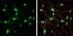 mGluR5 Antibody in Immunocytochemistry (ICC/IF)