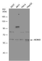 KCNV2 Antibody in Western Blot (WB)