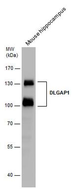 SAPAP1 Antibody in Western Blot (WB)