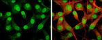 NEIL2 Antibody in Immunocytochemistry (ICC/IF)