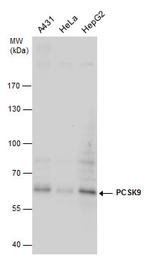 PCSK9 Antibody in Western Blot (WB)