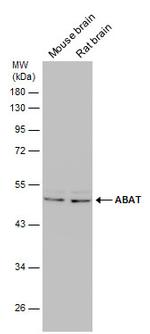 ABAT Antibody in Western Blot (WB)