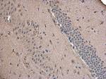 ABAT Antibody in Immunohistochemistry (Paraffin) (IHC (P))