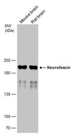 Neurofascin Antibody in Western Blot (WB)
