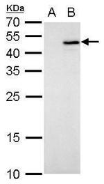 IL-28B Antibody in Western Blot (WB)