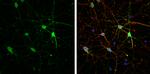 HCN1 Antibody in Immunocytochemistry (ICC/IF)