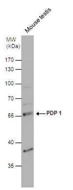 PDP1 Antibody in Western Blot (WB)