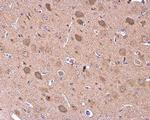 GDF6 Antibody in Immunohistochemistry (Paraffin) (IHC (P))