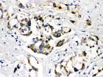 BSEP Antibody in Immunohistochemistry (Paraffin) (IHC (P))