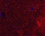 BSEP Antibody in Immunohistochemistry (Paraffin) (IHC (P))