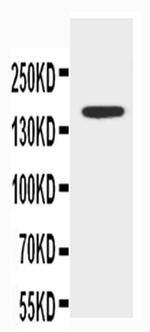 ABCB4 Antibody in Western Blot (WB)