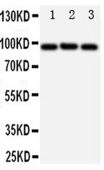 ABCB6 Antibody in Western Blot (WB)