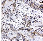 MRP1 Antibody in Immunohistochemistry (Paraffin) (IHC (P))