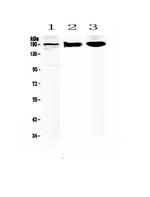 SUR1 Antibody in Western Blot (WB)