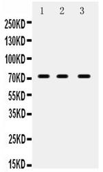 ABCG5 Antibody in Western Blot (WB)