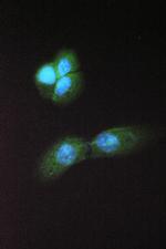 ABHD5 Antibody in Immunocytochemistry (ICC/IF)