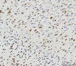 ABI1 Antibody in Immunohistochemistry (Paraffin) (IHC (P))