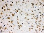 ABR Antibody in Immunohistochemistry (Paraffin) (IHC (P))