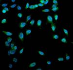 ACSL1 Antibody in Immunocytochemistry (ICC/IF)