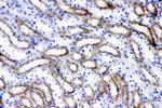 ACSL1 Antibody in Immunohistochemistry (Paraffin) (IHC (P))