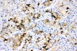 ACSL1 Antibody in Immunohistochemistry (Paraffin) (IHC (P))