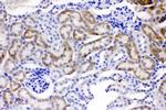 ACSL1 Antibody in Immunohistochemistry (Paraffin) (IHC (P))