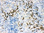 Actin Antibody in Immunohistochemistry (Paraffin) (IHC (P))