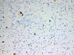 Adenosine Deaminase Antibody in Immunohistochemistry (Paraffin) (IHC (P))