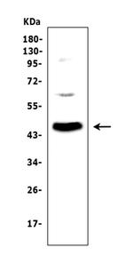 Adenosine Deaminase Antibody in Western Blot (WB)