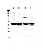 Adenosine Deaminase Antibody in Western Blot (WB)