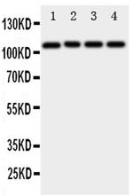 ADAM19 Antibody in Western Blot (WB)