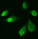 ADK Antibody in Immunocytochemistry (ICC/IF)