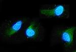 ADO Antibody in Immunocytochemistry (ICC/IF)