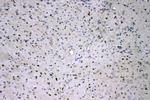 ADO Antibody in Immunohistochemistry (Paraffin) (IHC (P))