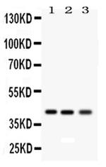 RAGE Antibody in Western Blot (WB)