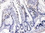 AKR1B1 Antibody in Immunohistochemistry (Paraffin) (IHC (P))