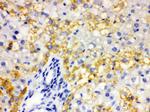 ALDH2 Antibody in Immunohistochemistry (Paraffin) (IHC (P))