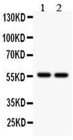 ALDH2 Antibody in Western Blot (WB)