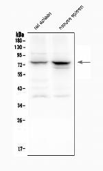 ALOX12 Antibody in Western Blot (WB)