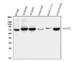 ALOX15 Antibody in Western Blot (WB)