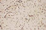 ALOX5 Antibody in Immunohistochemistry (Paraffin) (IHC (P))