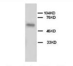 ALPL Antibody in Western Blot (WB)