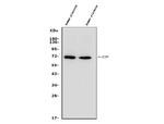 Placental Alkaline Phosphatase Antibody in Western Blot (WB)