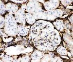 Annexin V Antibody in Immunohistochemistry (Paraffin) (IHC (P))