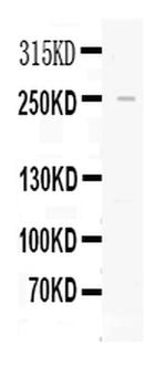 Apolipoprotein B Antibody in Western Blot (WB)