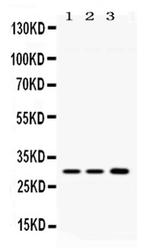 AQP11 Antibody in Western Blot (WB)